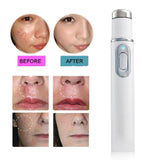 Blue Light Therapy Laser Pen Scar Acne Removal